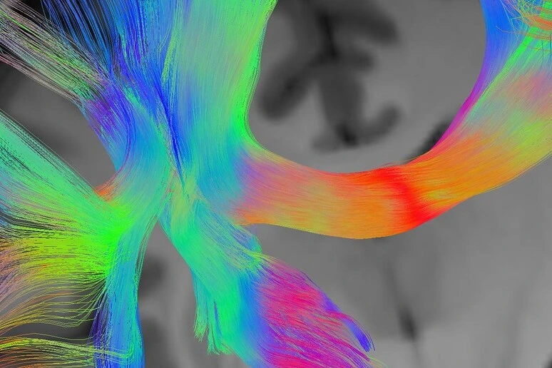 L’intelligenza come una sinfornia, nasce dal coordinamento del cervello