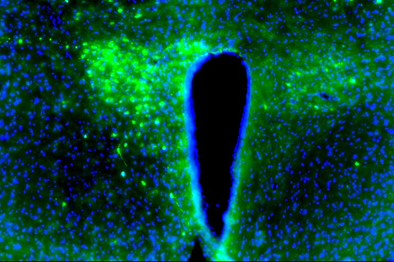 Il cancro interrompe il ritmo naturale del cervello