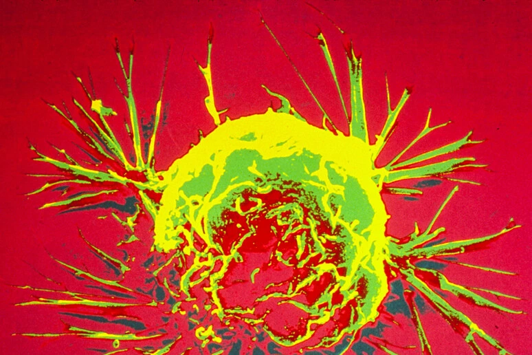 Nelle cellule tumorali allentato il freno che blocca il sistema immunitario