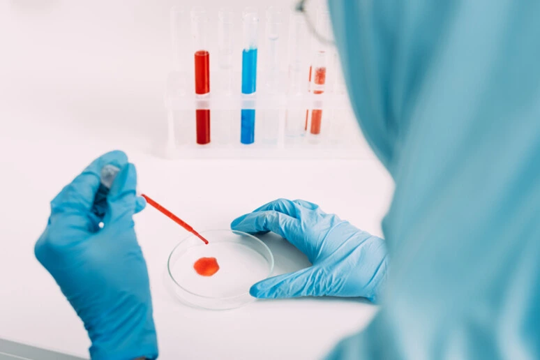 Alzheimer, test su proteina spia del sangue funziona anche per la popolazione asiatica