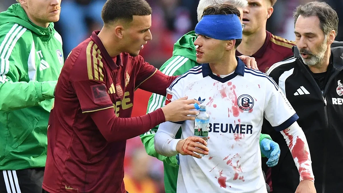 Kölns El Mala schubst – zwei Schalker blutig vom Platz!
